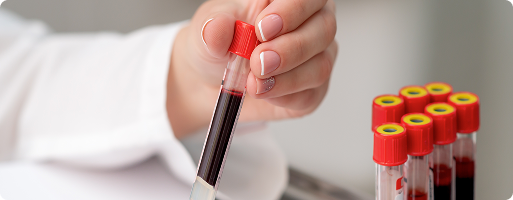  ¿Por qué son diferentes los resultados de los análisis de sangre?1