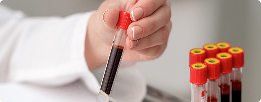 ¿Por qué son diferentes los resultados de los análisis de sangre?1